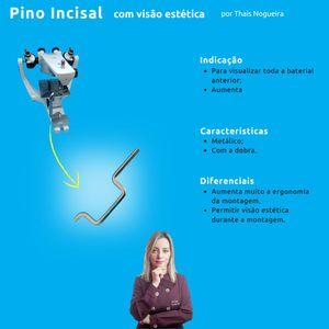 Pino Incisal com Visão Estética